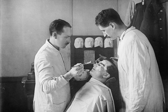 The First World War promoted advances in medicine, and in sectors such as aviation, that had not just military but also peacetime benefits, says David Stevenson. Here Captain Francis Derwent Wood treats the face of a patient, creating a mask which matches as closely as possible to the man's faces before he was injured, c1916. (Photo by Horace Nicholls/ IWM via Getty Images)